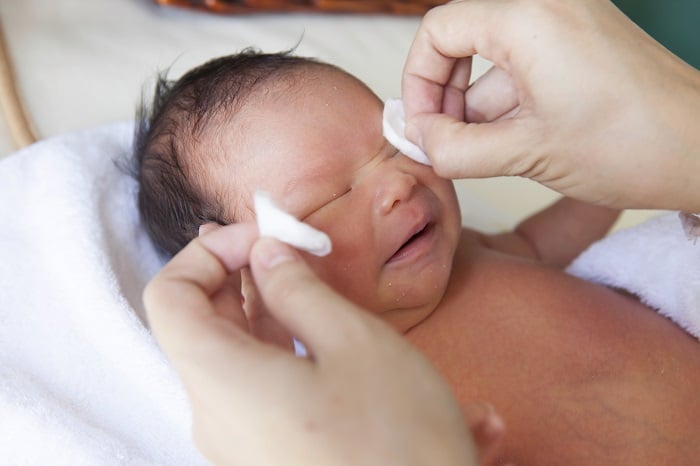 У новорожденного гноится глазик