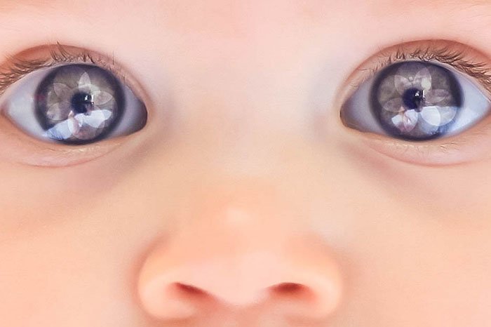 здоровье глаз малыша