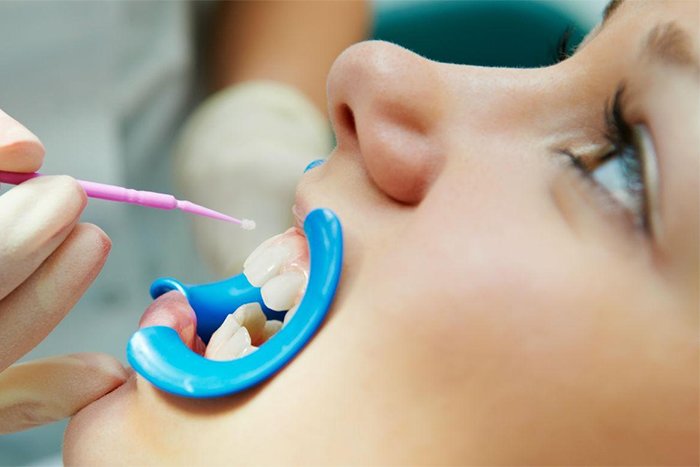 лечение молочных зубов у ребенка 