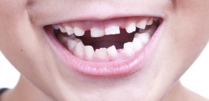 Смена молочных зубов на постоянные у ребенка